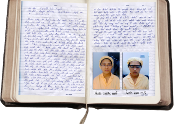 Phẫu thuật miễn phí trong chương trình Festival Sinh viên