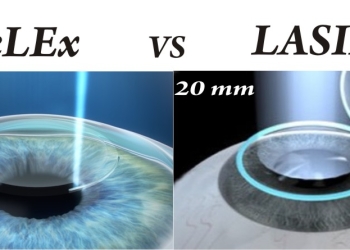 [:vi]Thêm sự lựa chọn cho phẫu thuật khúc xạ ngoài ReLEx SMILE và Femto-Lasik[:]