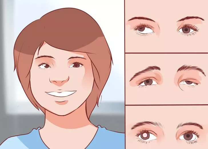 [:vi]Trẻ nhỏ nên được khám kiểm tra nhược thị khi lên 5 tuổi[:]