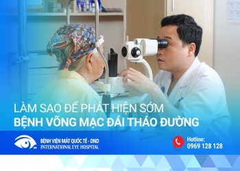[:vi]Làm thế nào để phát hiện sớm bệnh Võng mạc đái tháo đường?[:]