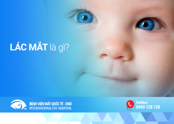 [:vi]Lác mắt và những hiểu biết cơ bản[:]