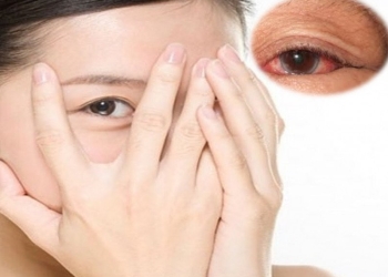 [:vi]Mắt tổn thương do dùng một số thuốc trong thời gian dài[:]