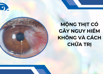 Mộng thịt có gây nguy hiểm không và cách chữa trị