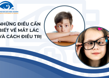 Những điều cần biết về mắt lác và cách điều trị