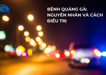 Bệnh quáng gà: Nguyên nhân và cách điều trị
