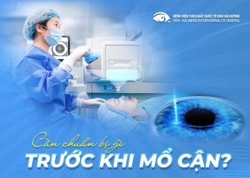 can-chuan-bi-gi-truoc-khi-mo-can