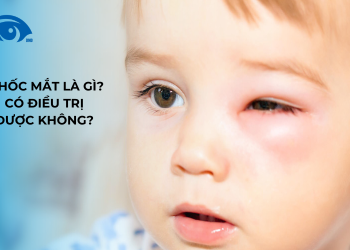 U hốc mắt là gì? Có điều trị được không