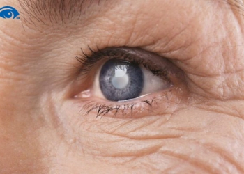 Cảnh báo dấu hiệu của suy giảm thị lực