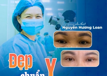 CẮT DA THỪA MÍ MẮT – ĐẸP TỰ NHIÊN, CHUẨN Y KHOA