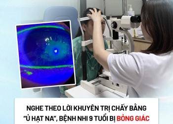Nghe theo lời khuyên trị chấy bằng “ủ hạt na”, bệnh nhi 9 tuổi bị bỏng giác mạc