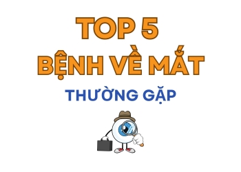 TOP 5 CÁC BỆNH VỀ MẮT CẦN CHÚ Ý