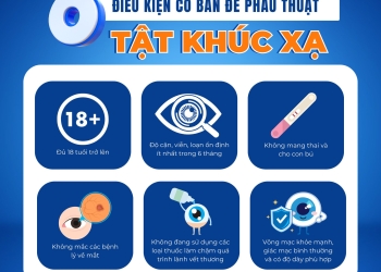 Điều Kiện Để Phẫu Thuật Mắt Xóa Cận: Bạn Cần Biết Gì Trước Khi Quyết Định?