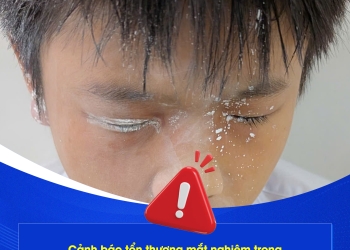 CẢNH BÁO: BỎNG MẮT NGUY HIỂM DO BÚT XÓA – BÀI HỌC CẢNH TỈNH CHO CÁC BẠN HỌC SINH