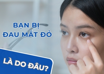 ĐAU MẮT ĐỎ – DỄ LÂY, DỄ BỊ, ĐỪNG CHỦ QUAN!