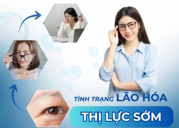Đừng để đôi mắt “già” hơn tuổi của bạn