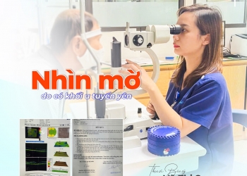 CẢNH BÁO: NHÌN MỜ KHÔNG CHỈ LÀ BỆNH MẮT CÓ THỂ LÀ DẤU HIỆU CỦA KHỐI U TUYẾN YÊN