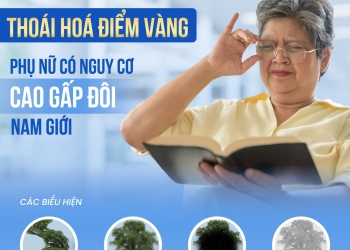 Thoái hóa điểm vàng: Cứ 10 người cao tuổi thì có 3 người mắc bệnh