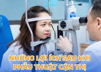 8 LÝ DO KHIẾN TEAM 4 MẮT MUỐN PHẪU THUẬT CẬN THỊ NGAY HÔM NAY!
