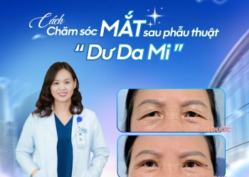 CÁCH CHĂM SÓC MẮT SAU PHẪU THUẬT DƯ DA MI