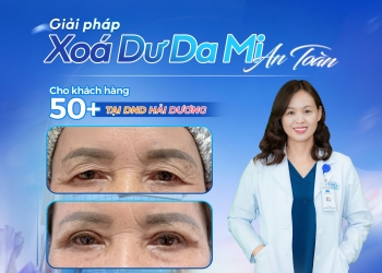 GIẢI PHÁP XÓA DƯ DA MI AN TOÀN CHO KHÁCH HÀNG 50+ TẠI DND HẢI DƯƠNG