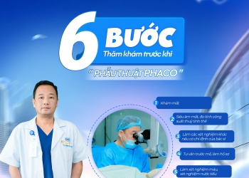 6 BƯỚC THĂM KHÁM TRƯỚC KHI PHẪU THUẬT PHACO – AN TOÀN BẮT ĐẦU TỪ KHÂU KHÁM