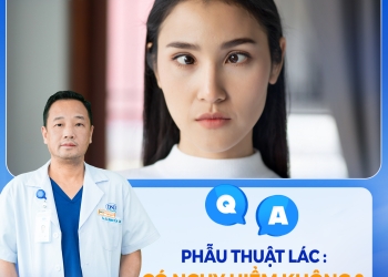 Phẫu thuật lác có nguy hiểm không? Bác sĩ giải đáp chi tiết