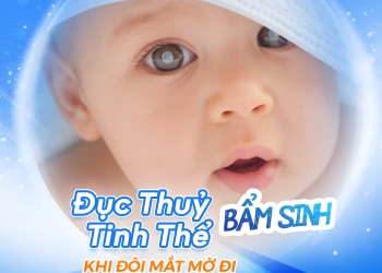 Đục thủy tinh thể bẩm sinh ở trẻ: Nhận biết sớm để tránh nguy cơ mù lòa
