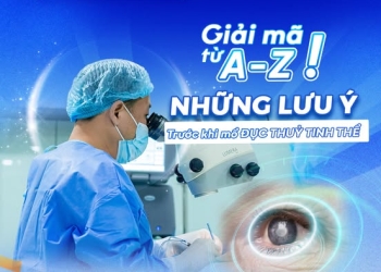 Giải mã từ A-Z những lưu ý trước khi phẫu thuật đục thủy tinh thể