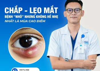 CHẮP VÀ LẸO MẮT KHÁC NHAU NHƯ THẾ NÀO? CÁCH NHẬN BIẾT VÀ XỬ LÝ ĐÚNG