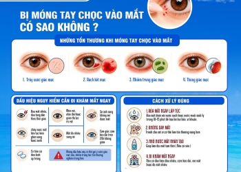 Bị móng tay chọc vào mắt có sao không? Cảnh báo trầy xước giác mạc và cách xử lý đúng