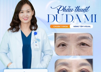 XÓA DƯ DA MI CHUẨN Y KHOA – NÂNG TẦM VISUAL TRẺ TRUNG TỰ NHIÊN
