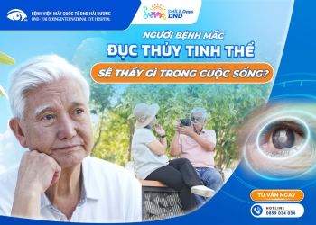 Khi Đôi Mắt Không Còn Nhìn Rõ – Cảnh Báo Đục Thủy Tinh Thể Ở Người Lớn Tuổi