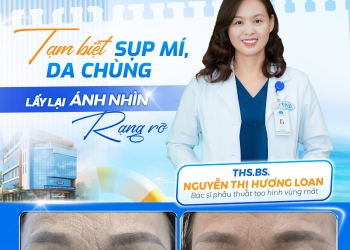 Cắt mí mắt Hải Dương – Giải pháp hết sụp mí, trẻ hóa ánh nhìn tự nhiên