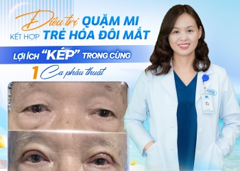 Điều Trị Quặm Mi Kết Hợp Trẻ Hóa Mắt – Giải Pháp 2 Trong 1 Hiệu Quả