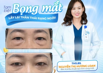 CẮT BỌNG MỠ MẮT: TẠM BIỆT BỌNG MẮT, LẤY LẠI THẦN THÁI RẠNG NGỜI