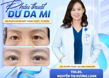 PHẪU THUẬT DƯ DA MI: GIẢI PHÁP CẢI THIỆN VÙNG MẮT TỰ NHIÊN, HÀI HÒA