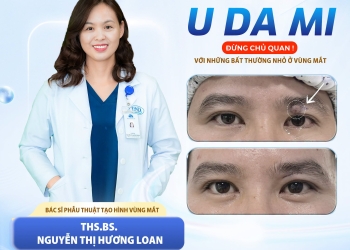 U DA MI: ĐỪNG CHỦ QUAN VỚI NHỮNG BẤT THƯỜNG NHỎ Ở VÙNG MẮT