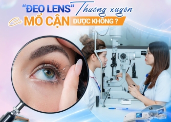 ĐEO LENS THƯỜNG XUYÊN CÓ MỔ CẬN ĐƯỢC KHÔNG?