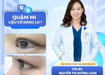 QUẶM MI CÓ ĐÁNG LO? THS.BS. NGUYỄN THỊ HƯƠNG LOAN GIẢI ĐÁP