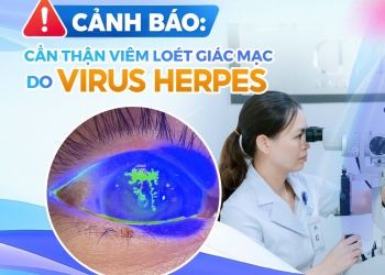 Cảnh báo viêm loét giác mạc do virus Herpes: Dấu hiệu không nên chủ quan