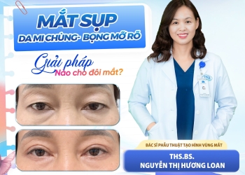 Mắt sụp, da mi chùng, bọng mỡ rõ: Giải pháp nào giúp đôi mắt tươi tắn hơn?